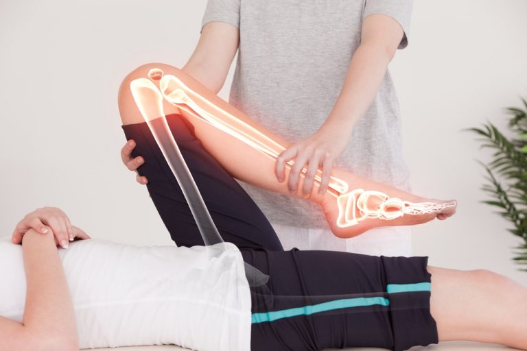 Fisioterapia
